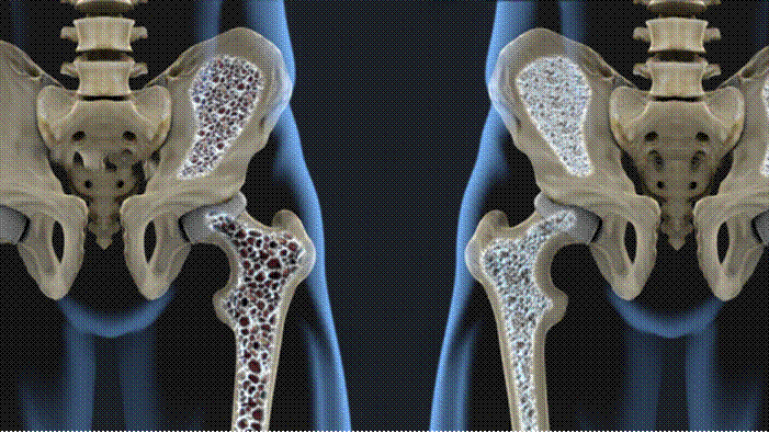 clip_image002.gif