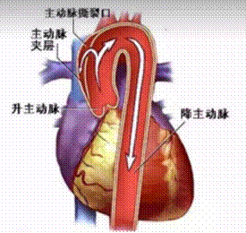 clip_image004.gif