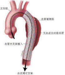clip_image010.gif