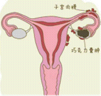 clip_image002.gif