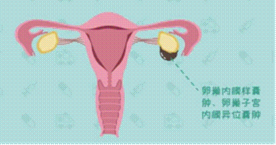 clip_image008.gif