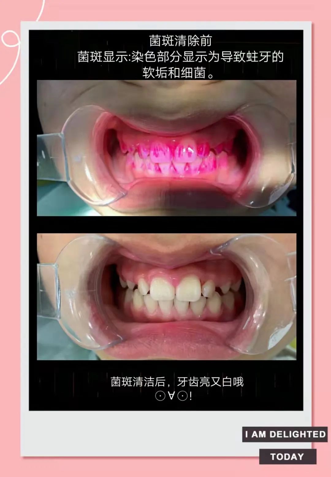 5_ibT8iaP9L9EUIwCMRem1X5OM1FRiaw.jpg