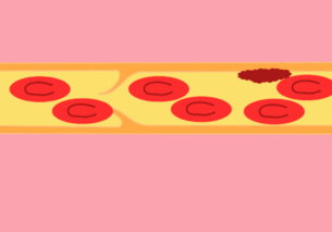 9_BVEjdKdiaZGNQw639ibmPK0kn8vGoQ.gif